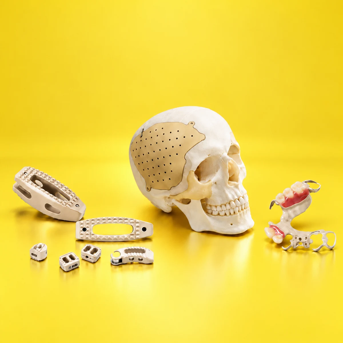 Craniofacial fixation components