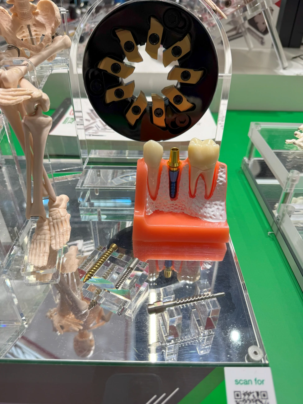 Thread-whirling tooling and dental implant display
