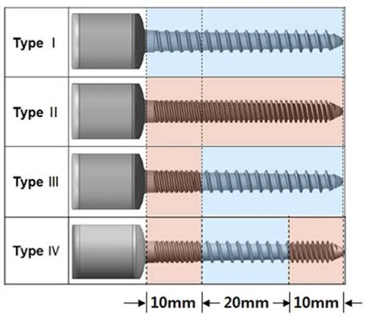 Examples of different thread geometries
